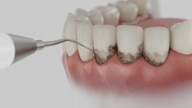 Trusted Dental Implants service in Forest Glen, MD - Dentist Open Now